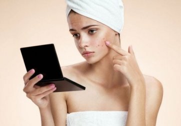6 remédios caseiros para eliminar as espinhas