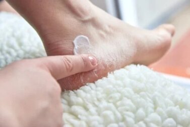 Calcanhares rachados: esfoliação e máscara para os pés