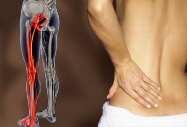 6 exercícios fáceis para eliminar a dor ciática