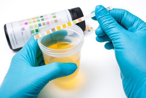 Alterações na urina podem ser sintoma de insuficiência renal