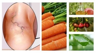 Tratamento de varizes com aloe vera, cenoura e vinagre de maçã