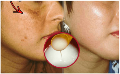 Creme natural para clarear a pele do rosto
