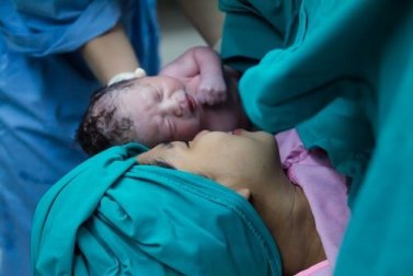 Bebês nascidos por cesárea recebem "banho" de bactérias vaginais