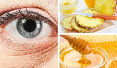 Máscara natural de abacaxi para rugas sob os olhos