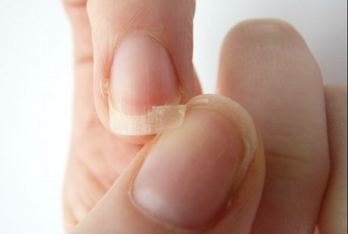 9 coisas que tornam as unhas quebradiças