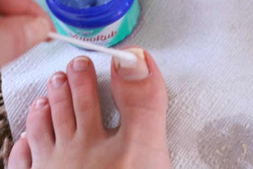 Vick Vaporub para combater fungo nos pés