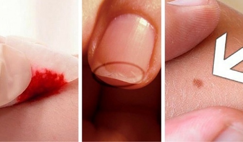 5 razões surpreendentes para visitar o dermatologista