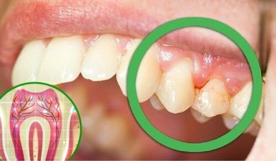 6 razões pelas quais os dentes doem