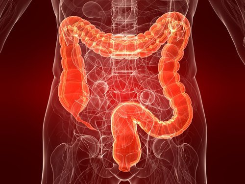 Colite ulcerosa: uma enfermidade ainda desconhecida