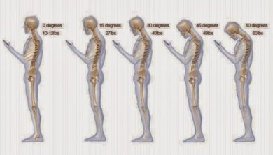 6 hábitos que estão prejudicando seu pescoço