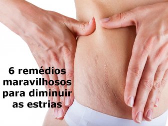 6 remédios maravilhosos para diminuir as estrias