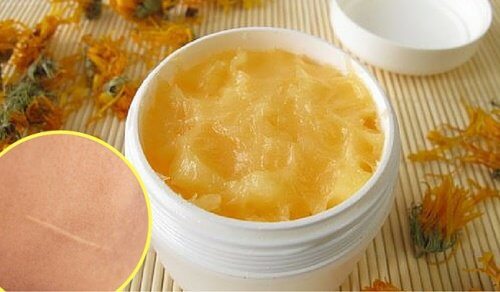 Creme natural para diminuir o tamanho das cicatrizes e cortes Creme natural para diminuir o tamanho das cicatrizes e cortes
