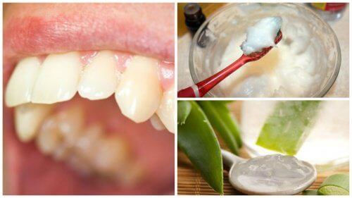 Elimine a placa bacteriana com estes interessantes remédios naturais Elimine a placa bacteriana com estes interessantes remédios naturais
