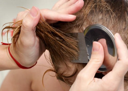 7 formas naturais para eliminar os piolhos