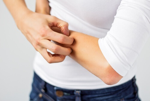 Alergia às bijjouterias