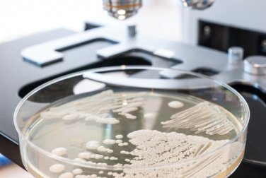 10 alimentos que limitam o desenvolvimento da cândida