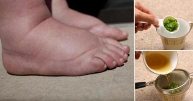 Este é um dos melhores remédios para aliviar o inchaço dos pés
