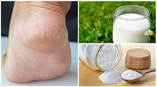 Combine estes dois ingredientes naturais para ter pés macios e bonitos