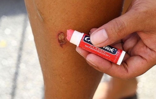 protetor-labial-ferida