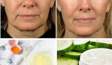 5 remédios caseiros para combater a flacidez facial