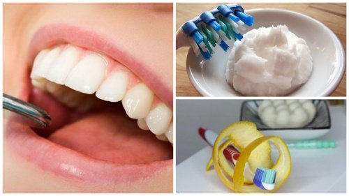6 truques caseiros para remover o tártaro