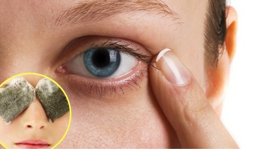 5 remédios caseiros para combater as olheiras