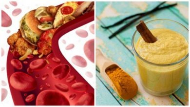 Os 5 melhores remédios caseiros para limpar as artérias obstruídas