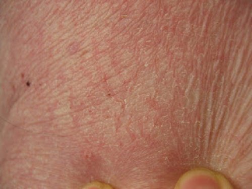 5 receitas para tratar a pele seca nas diferentes partes do corpo