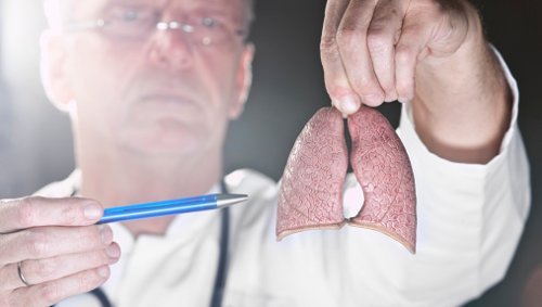 Médico explicando tudo sobre o câncer de pulmão