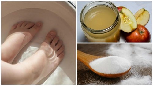 Combine dois ingredientes para se desfazer dos fungos nas unhas