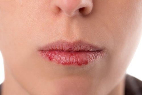 Sintomas de câncer de orofaringe que você deve conhecer: muito importante! Sintomas de câncer de orofaringe que você deve conhecer: muito importante!