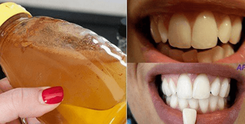 Branqueie seus dentes em casa com um ingrediente 100% natural Branqueie seus dentes em casa com um ingrediente 100% natural