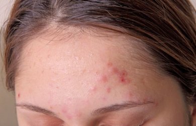 9 sinais de uma sobrecarga de toxinas