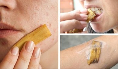 11 formas de usar as cascas de banana