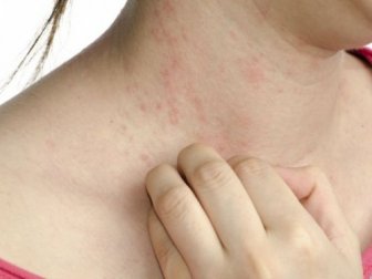 5 sintomas da diabetes pouco conhecidos