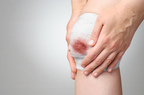 As feridas que demoram em sarar podem indicar o enfraquecimento do sistema imunológico