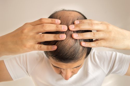 Problemas de perda de cabelo por causa do fígado