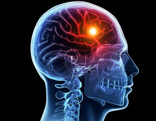 Ilustração de cérebro com dor de cabeça
