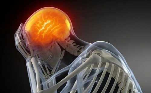 Em que momento uma dor de cabeça passa a ser algo preocupante?