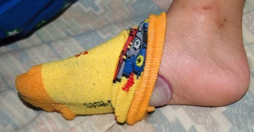 4 benefícios de dormir com uma cebola nos pés