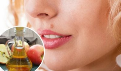 Como eliminar os sinais na pele naturalmente