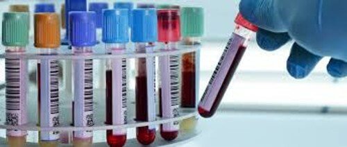 Um exame de sangue para diagnosticar a depressão