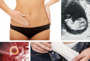 Por que acontecem dois períodos menstruais em um mês?