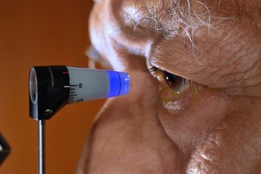 Como prevenir o glaucoma de forma natural