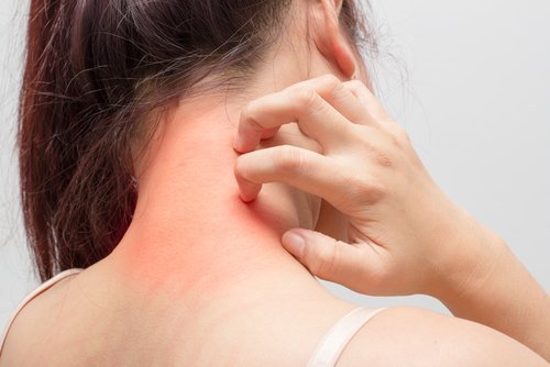 Mulher se coçando pelo eczema na pele