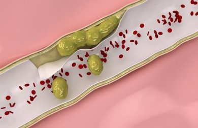 Limpe as artérias naturalmente com esses alimentos