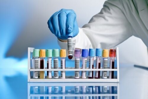 O vírus do HIV foi completamente eliminado do sangue de um paciente britânico