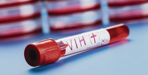 Sangue com HIV