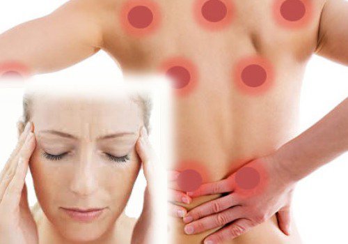 Pontos de dor na fibromialgia