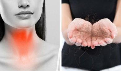 Como combater a perda de cabelo devido à tireoide
